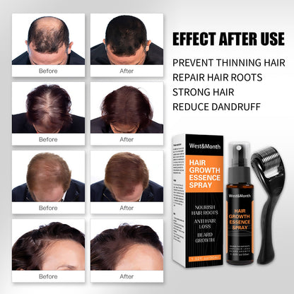 Mirvalisii Hair Growth Spray for Healthy Scalp Care