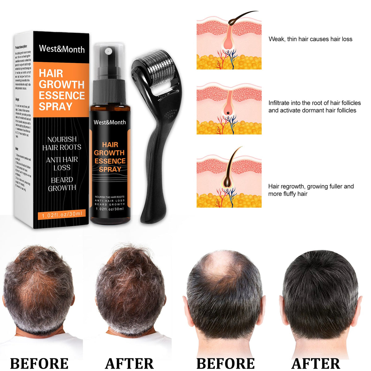 Mirvalisii Hair Growth Spray for Healthy Scalp Care
